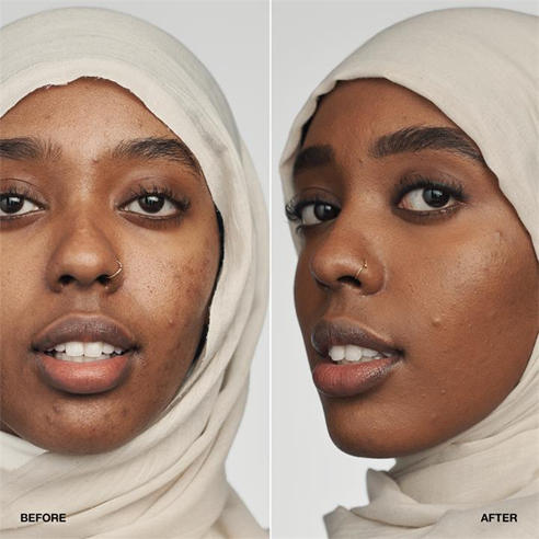 Clinique - Even Better Clinical™ Serum Foundation SPF20