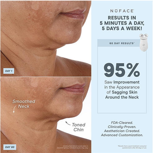 Nuface - Trinity+ Lip & Eye Attachment Firming and Toning Device